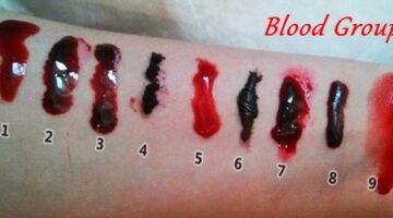 Why-all-peoples-blood-type-are-different