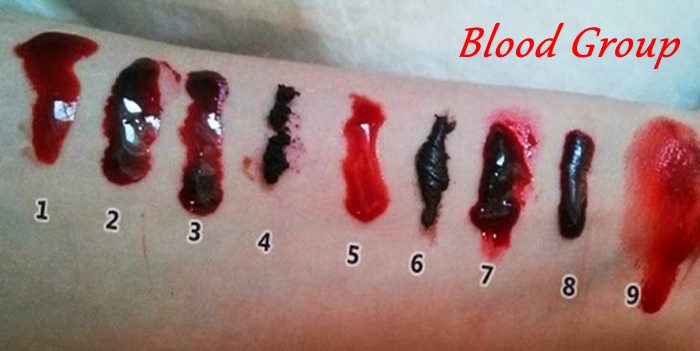 Why-all-peoples-blood-type-are-different